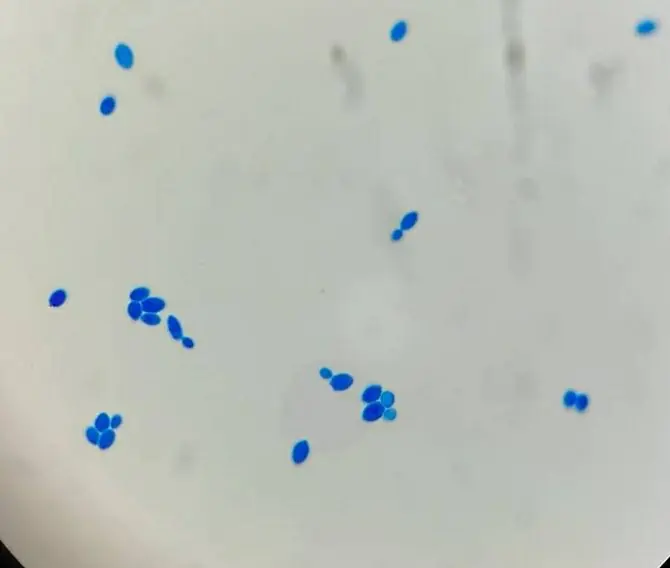 CMethylene blue staining of yeasts